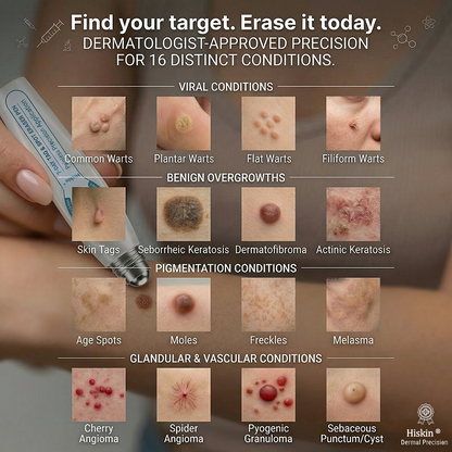 💖👩‍⚕️𝐎𝐟𝐟𝐢𝐜𝐢𝐚𝐥 𝐁𝐫𝐚𝐧𝐝 𝐒𝐭𝐨𝐫𝐞 |✅💎Hiskin ® 7-𝐷𝑎𝑦 𝗧𝐚𝐠 & 𝗦𝗽𝐨𝐭 𝐄𝐫𝒂𝒔𝒆𝒓(Zero Pain, Zero 𝐒𝐜𝐚𝒓𝒔 Rollerball)