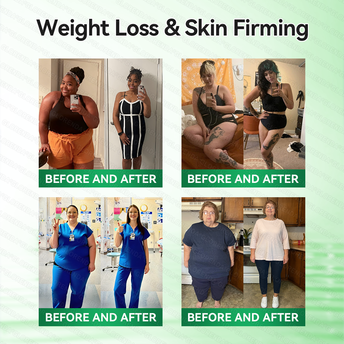 𝑶𝒇𝒇𝒊𝒄𝒊𝒂𝒍 𝑺𝒕𝒐𝒓𝒆  | 💯💯𝐂𝐚𝐫𝐞𝐔𝐩𝐥𝐢𝐟𝐭®𝑴𝒐𝒓𝒊𝒏𝒈𝗮 · 𝗕𝗲𝗿𝗯𝗲𝗿𝙞𝙣𝙚 × 𝙉𝘼𝐃+ 𝟏𝟎-𝐢𝐧-𝟏 𝗔𝗱𝘃𝗮𝗻𝗰𝙚𝙙 𝙉𝙖𝙣𝙤 𝙈𝙞𝙘𝙧𝙤𝙣𝙚𝙚𝐝𝐥𝐞 𝐏𝐚𝐭𝙘𝙝🇺🇸(𝐉𝐮𝐬𝐭 𝐨𝐧𝐜𝐞 𝐚 𝐝𝐚𝐲, 𝐯𝐢𝐬𝐢𝐛𝐥𝐞 𝐜𝐡𝐚𝐧𝐠𝐞𝐬 𝐢𝐧 𝟕 𝐝𝐚𝐲𝐬） ✅ 𝐅𝐨𝐫 𝐨𝐛𝐞𝐬𝐢𝐭𝐲, 🅛🅞🅞🅢🅔 🅢🅚🅘🅝,𝐝𝐢𝐚𝐛𝐞𝐭𝐞𝐬, 𝐬𝐥𝐞𝐞𝐩 𝐚𝐩𝐧𝐞𝐚, 𝐣𝐨𝐢𝐧𝐭 𝐢𝐬𝐬𝐮𝐞𝐬, 𝐚𝐧𝐝 𝐦𝐨𝐫𝐞💯💯